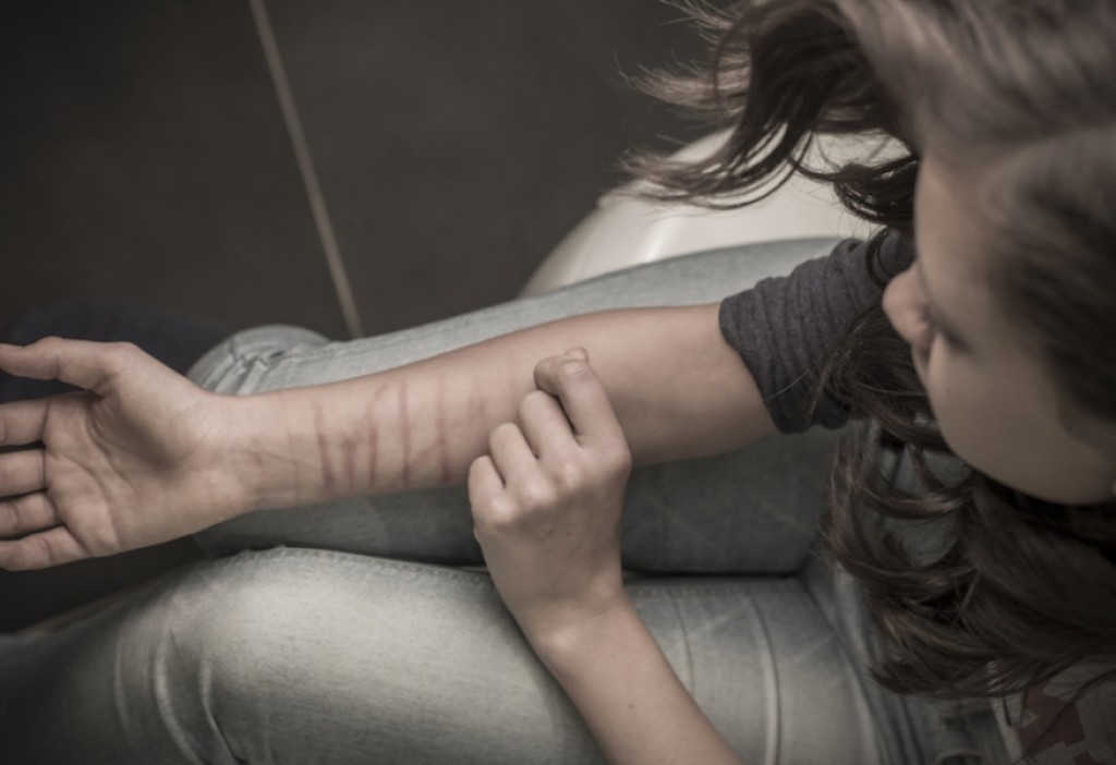 a A-child-self-harming